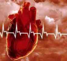 Bolesti kardiovaskularnog sustava