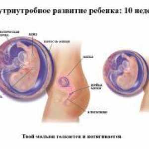 Poroda 10 tjedna trudnoće