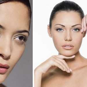10 Načina kako ukloniti ožiljci i acne ožiljaka na licu