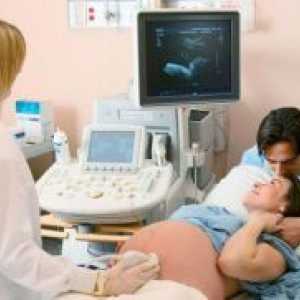 Poroda 14 tjedna trudnoće