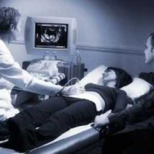 21 Tjedana trudna - ultrazvuk