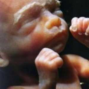 24 Tjedna trudnoće - fetalni veličina