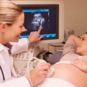 26 Tjedna trudnoće - fetalni veličina