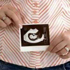 6 Tjedana gestacije - fetalni razvoj