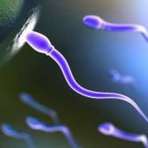 Agregacija spermija