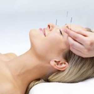 Akupunktura za mršavljenje