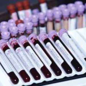 Krv u onkologiji