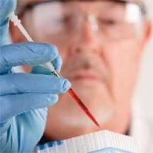 Test krvi za djecu - prijepis