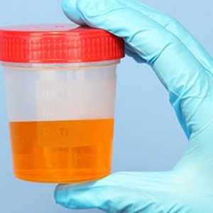 Analiza urina kod djece