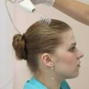Androgene alopecije kod žena - liječenje