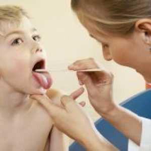 Antibiotici za upalu grla kod djece