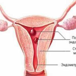 Trudnoća i endometrija polip