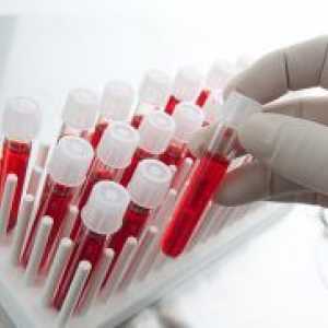 Krv biokemija - prijepis