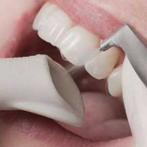 Zubi za čišćenje protok zraka - što je to?