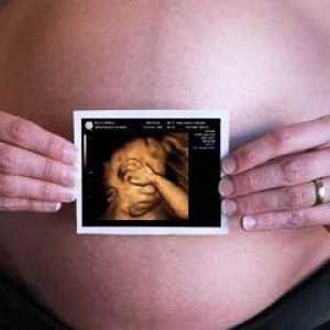 Što je 3D ultrazvuk u trudnoći