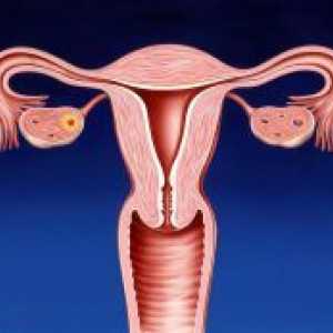 Što je cerviks u žena?
