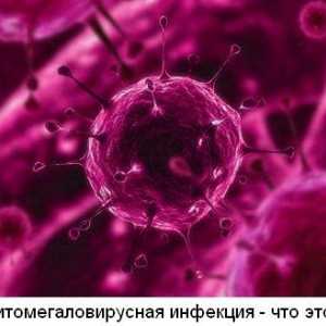 Citomegalovirus (CMV) - što je to?