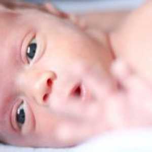 Boja očiju kod novorođenčadi