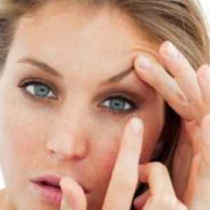Acne očiju - simptomi i tretman