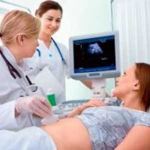 Dopler ultrazvuk u trudnoći - pravila