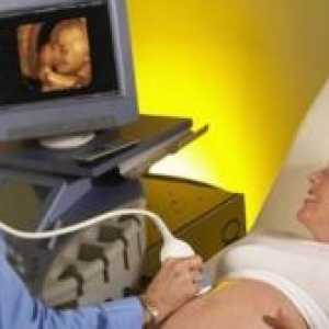 Doppler u trudnoći - prijepis