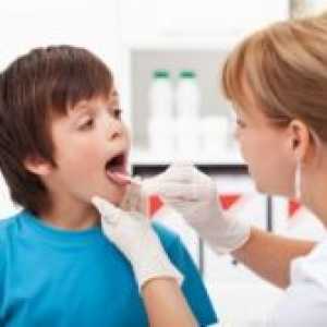 Faringitis u djece - liječenje