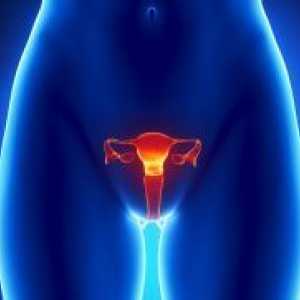 Uterine fibroids - Simptomi