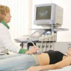 Fibromatoze maternice