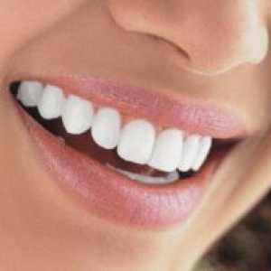 Fluoridizaciji zuba