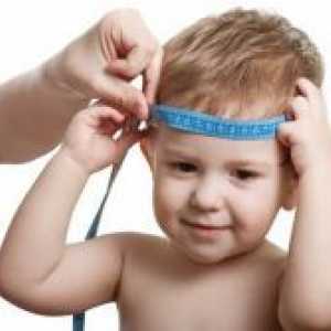 Hidrocefalus kod djece