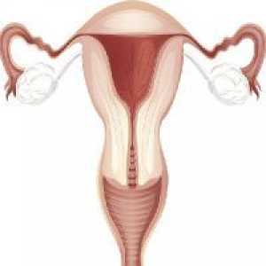 Hipoplazija maternice