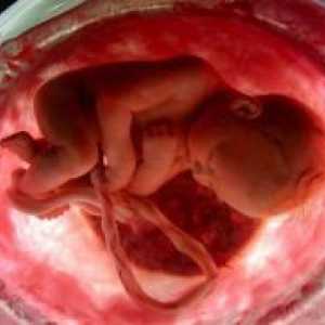 Fetalna pothranjenost
