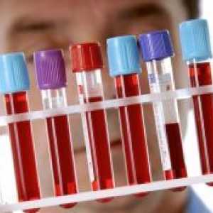 Test krvi imunohistokemija