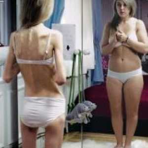 Indeks tjelesne mase kod žena