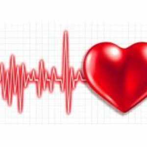 Srce EKG