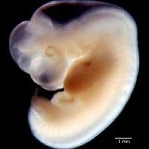 Embrija 6 tjedana