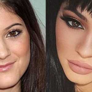 Kylie Jenner prije i nakon plastične