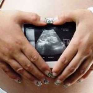 Koliko često mogu učiniti ultrazvuk u trudnoći?
