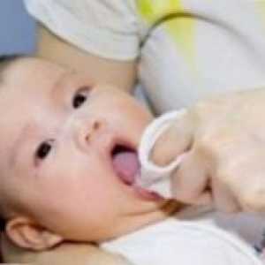 Kako se postupa s kvasac infekcije u novorođenčadi?