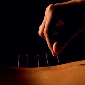 Kako pronaći i djeluju na akupunkturne točke?