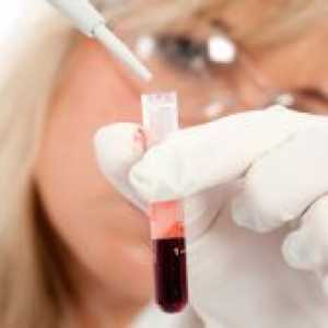 Kako odrediti krvnu grupu?