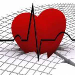 Kako prepoznati srčani udar?
