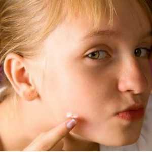 Kako ukloniti akne na obrazima