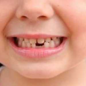 Što su zubi ispasti u djece?