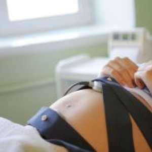 Fetalni ultrazvuk