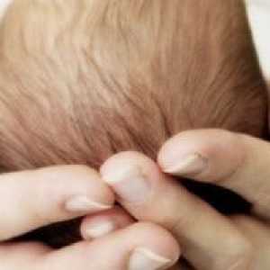 Mozak cista u novorođenčadi