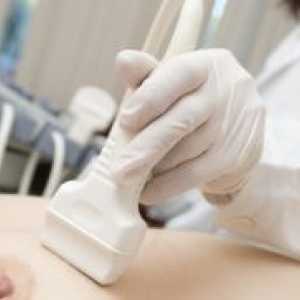 Kada se radi ultrazvuk dojke?
