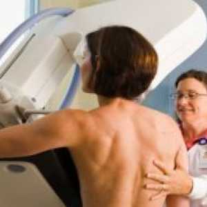 Kada je najbolje učiniti mamografiju?