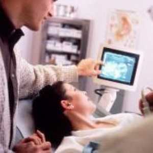 Kada se vidi na ultrazvuk trudnoće?