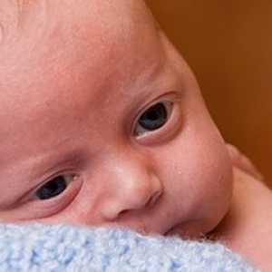 Konjunktivitis u novorođenčadi